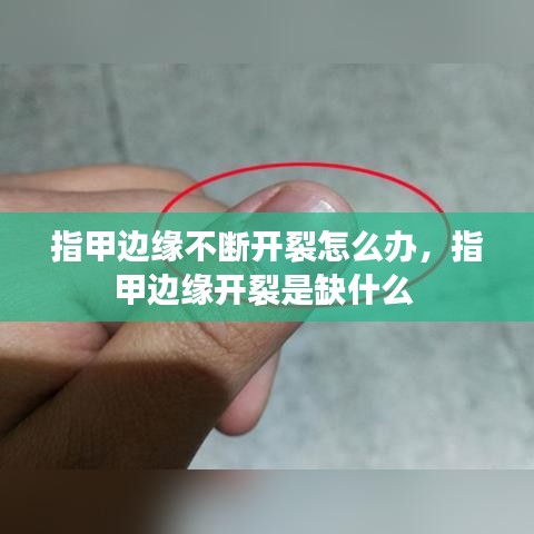 指甲边缘不断开裂怎么办，指甲边缘开裂是缺什么 