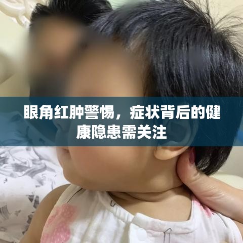 眼角红肿警惕，症状背后的健康隐患需关注